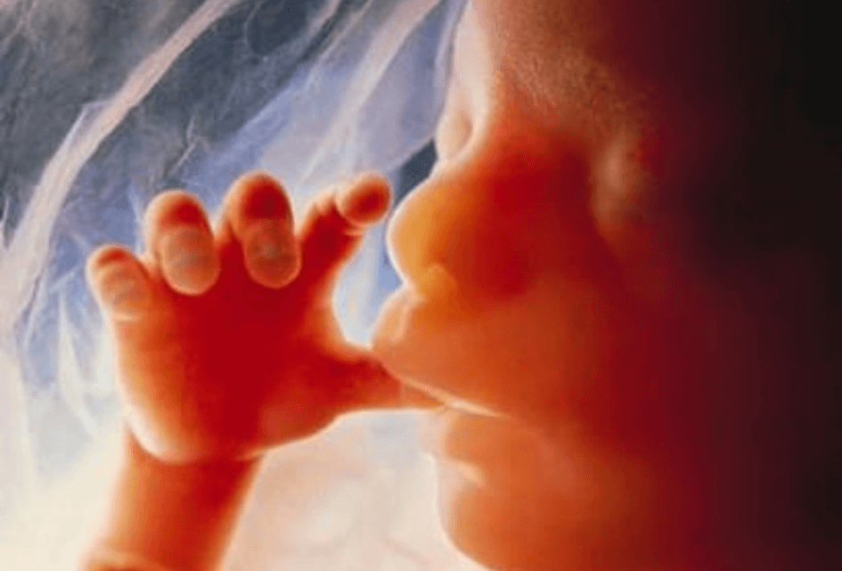 'De abortuspil beëindigt een wonder’