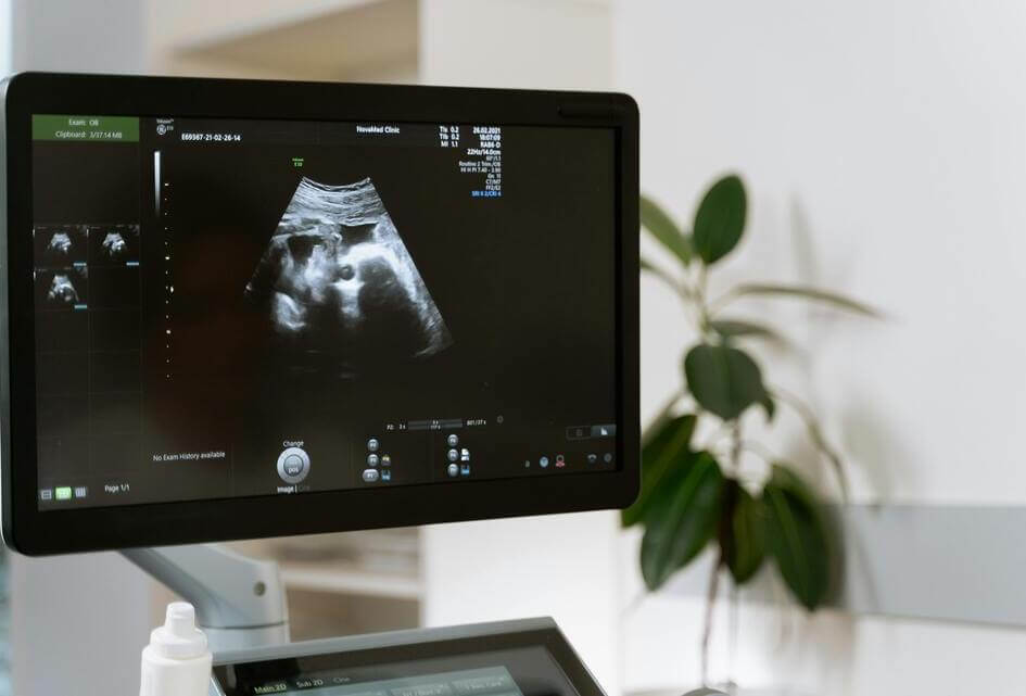 Ruissen vraagt opheldering Europese Commissie over burgerinitiatief abortustoerisme