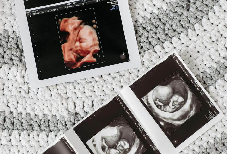‘Als je dit niet aankunt, moet je abortus stoppen!’