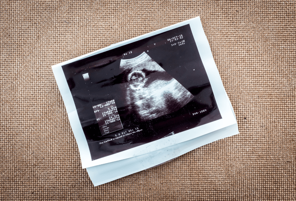 SGP wil contracten EU-abortuslobby inzien