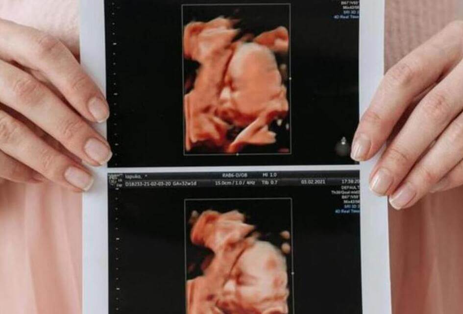 Commissie doet ontstellende ontdekking over onverdoofd aborteren, SGP wil debat