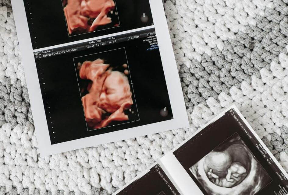 Fiom wil dat media het ongeboren leven verzwijgen