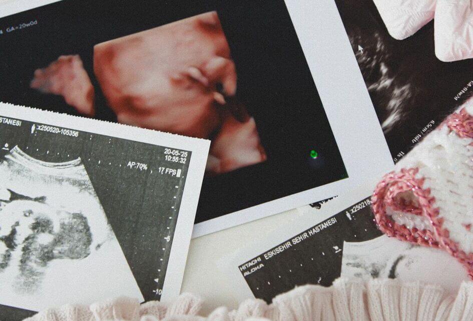 SGP: doorgaan proef late abortussen diep betreurenswaardig