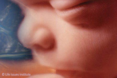 Debat abortus