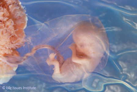 Aborteren van meisjes