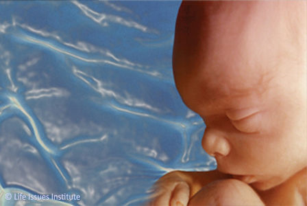Abortus opnieuw op politieke agenda