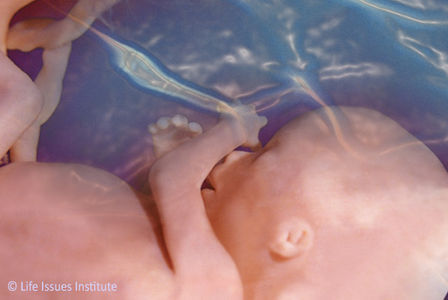 Campagne over abortus