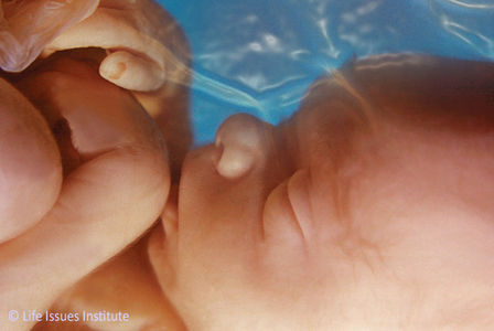 SGP: evaluatie abortuswet moet grondiger
